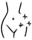 Points and Stretch Marks